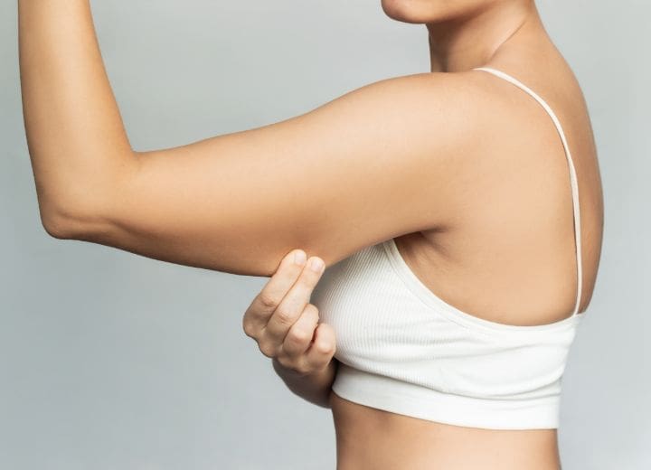 HR Plastic Surgery - Excess / Loose Arm Skin